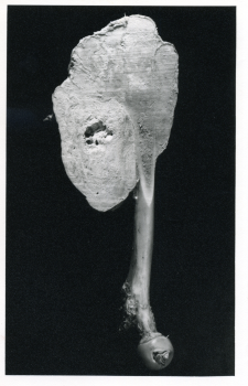 BONE, femur